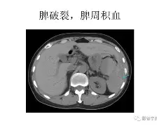 納貢遭受腹部傷勢，損失無法突破